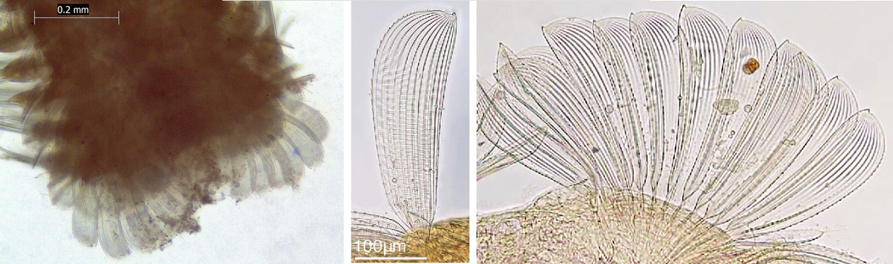 Microscopic view of portion of a worm showing the arrangement of hairs, and detail of the hairs which look like transparent, ridged paddles.
