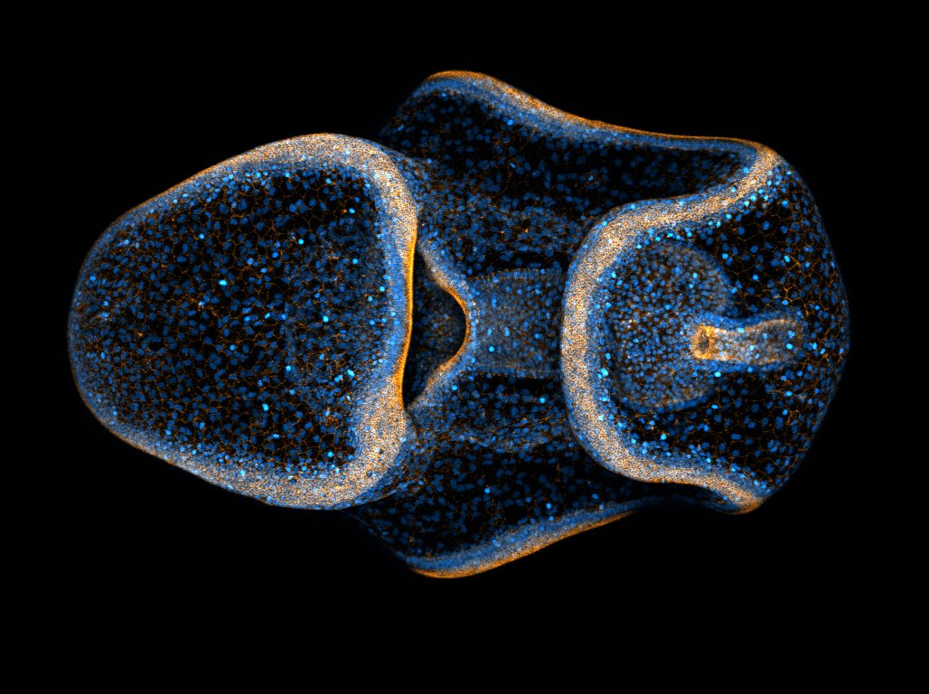 Transparent sea star larva with blue and orange dots scatted over its surface, on a black background